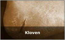 Kloven