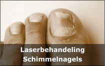 Laserbehandeling Schimmelnagels