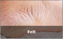 Eelt